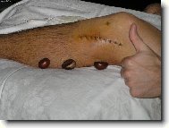 z�ti�� s jizvou a ka�tany